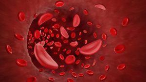 More than 1 crore screened for Sickle Cell Disease under National Sickle Cell Anaemia Elimination Mission