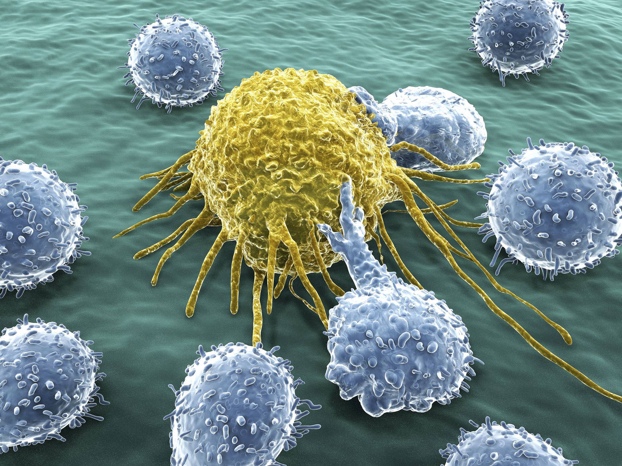 Scientists discover key enzyme to overcome cancer drug resistance