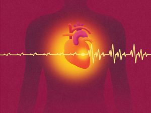 Mammography finding in arteries could indicate heart disease