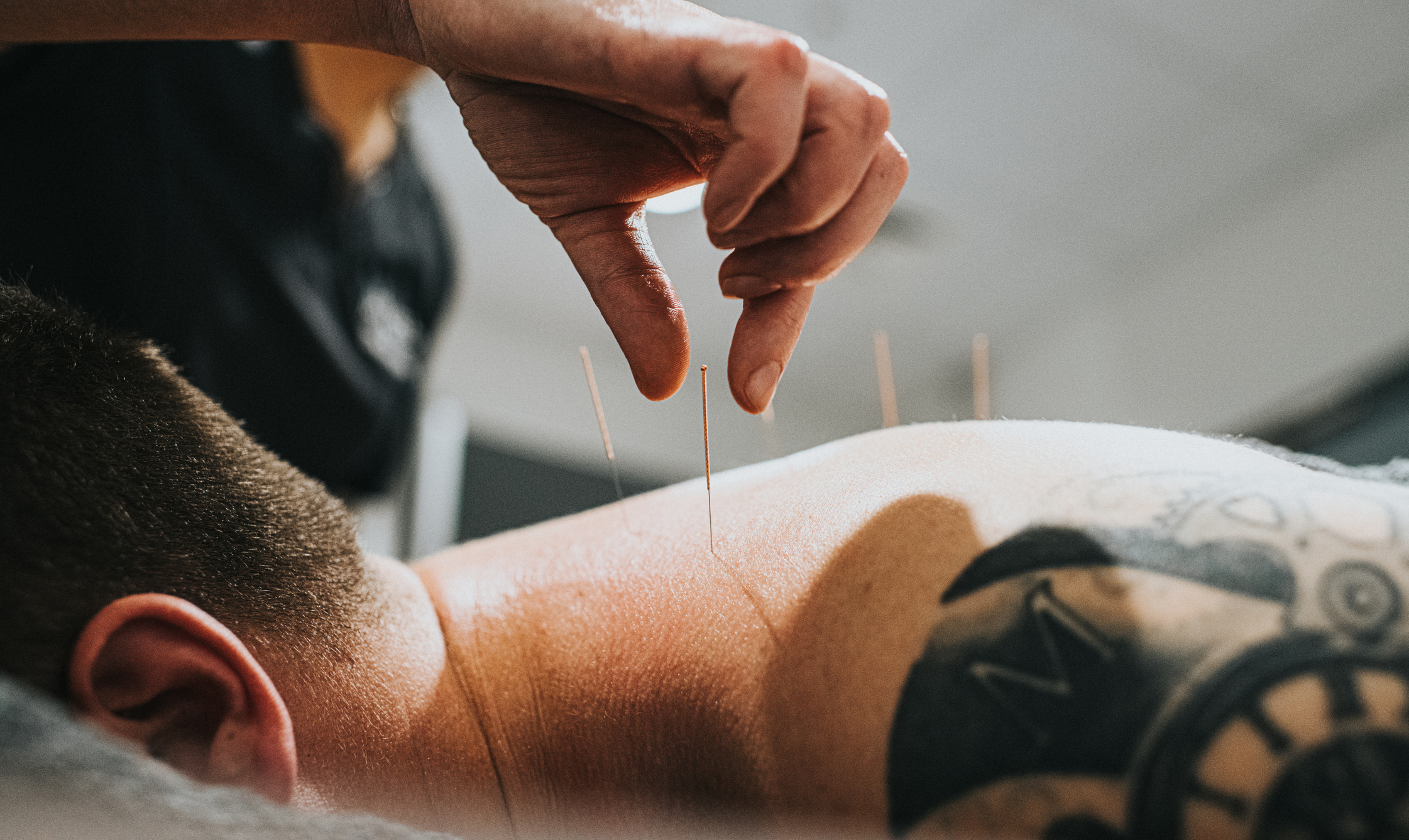 Acupuncture reduces leg pain from a herniated disk