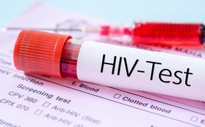 Zimbabwe records 5,932 AIDS-related deaths in first half of 2025: Health Minister