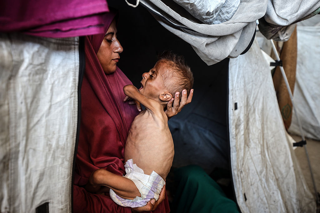 Gaza running out of specialised food to save malnourished children