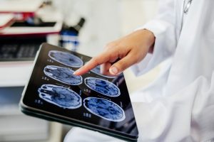 Why is leucovorin being considered as an autism treatment?
