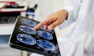 Research suggests this daily habit can lower dementia risk by 35%