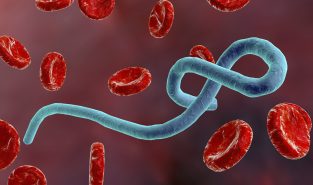 Government Closely Monitoring Ebola Situation in Central Africa; Public Health Measures Being Strengthened