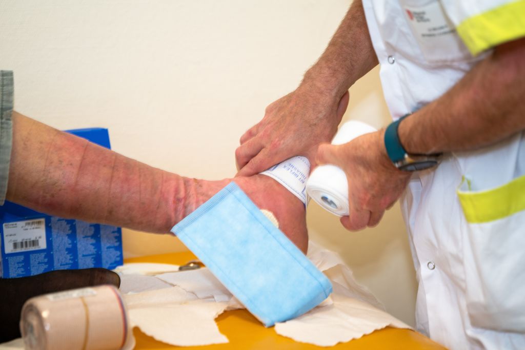 Nagaland University researchers find plant compound to treat diabetic wounds, foot ulcers