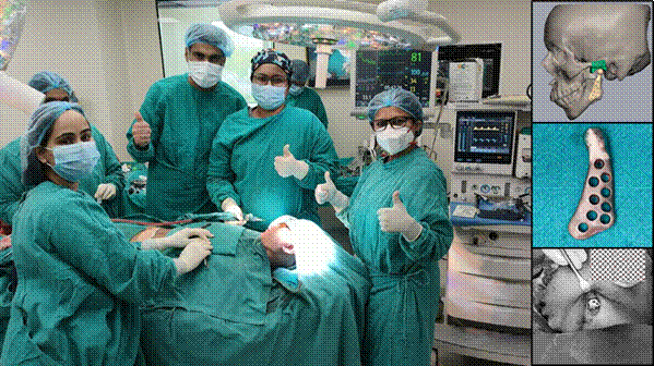 Indigenous TMJ implant successfully performed on four patients in Delhi