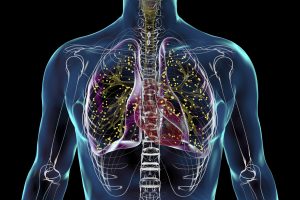 India records 21% decline in TB incidence, nearly double global rate: WHO report