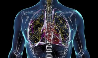 India records 21% decline in TB incidence, nearly double global rate: WHO report