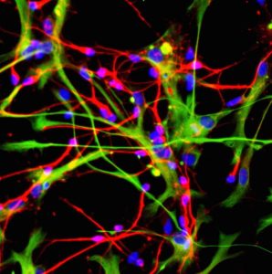 Fat-Derived Stem Cells Show Promise in Healing Spinal Fractures: Osaka Study
