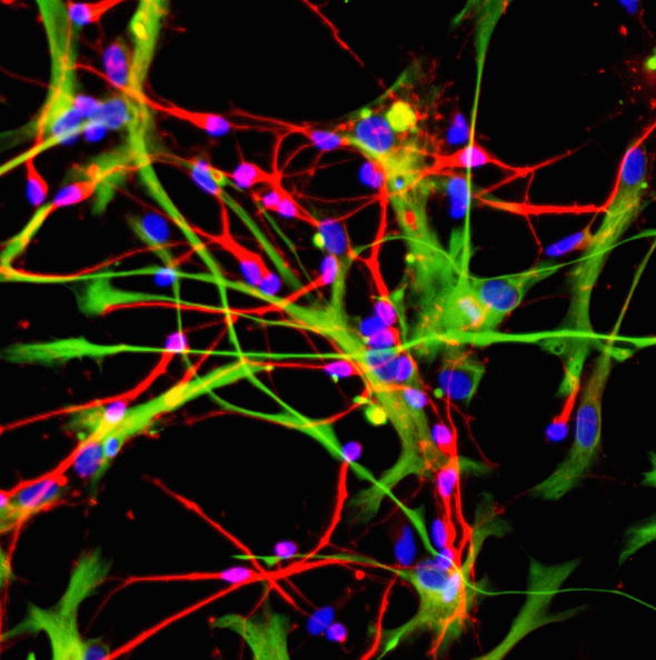 Fat-Derived Stem Cells Show Promise in Healing Spinal Fractures: Osaka Study