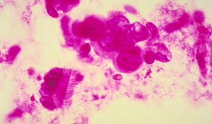 Scientists develop ‘CLEAR’ technology for advanced protein imaging in cancer research