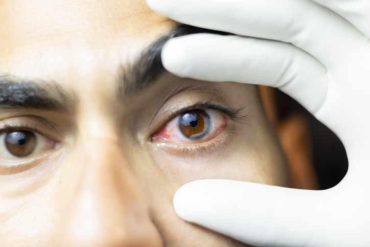 Indian researchers develop new peptide therapy to treat eye infections