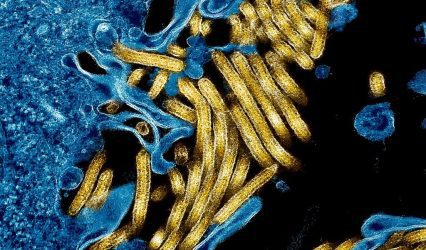 France reports Ebola case in doctor returning from Congo