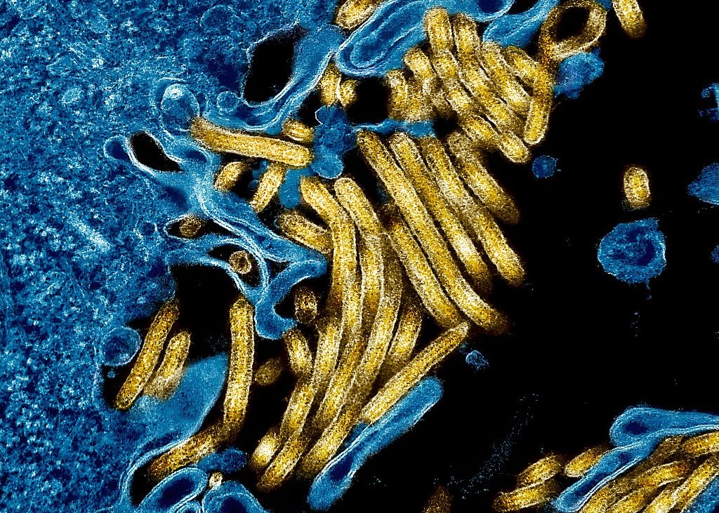 France reports Ebola case in doctor returning from Congo