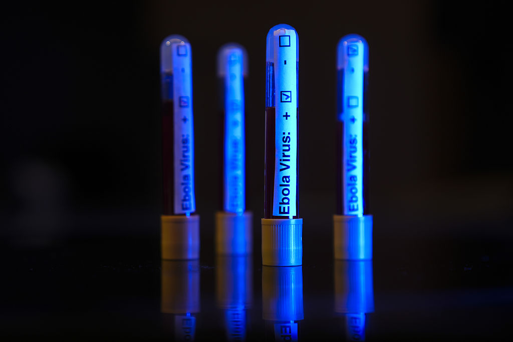 Race for rapid Ebola test narrows to five potential manufacturers