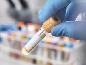 India’s fight against hepatitis: How the country is working towards eliminating the disease by 2030