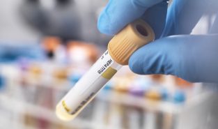 India’s fight against hepatitis: How the country is working towards eliminating the disease by 2030