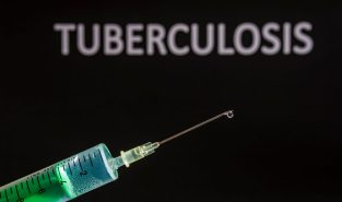 Nanded university gets Indian patent for nano drug delivery technology for tuberculosis