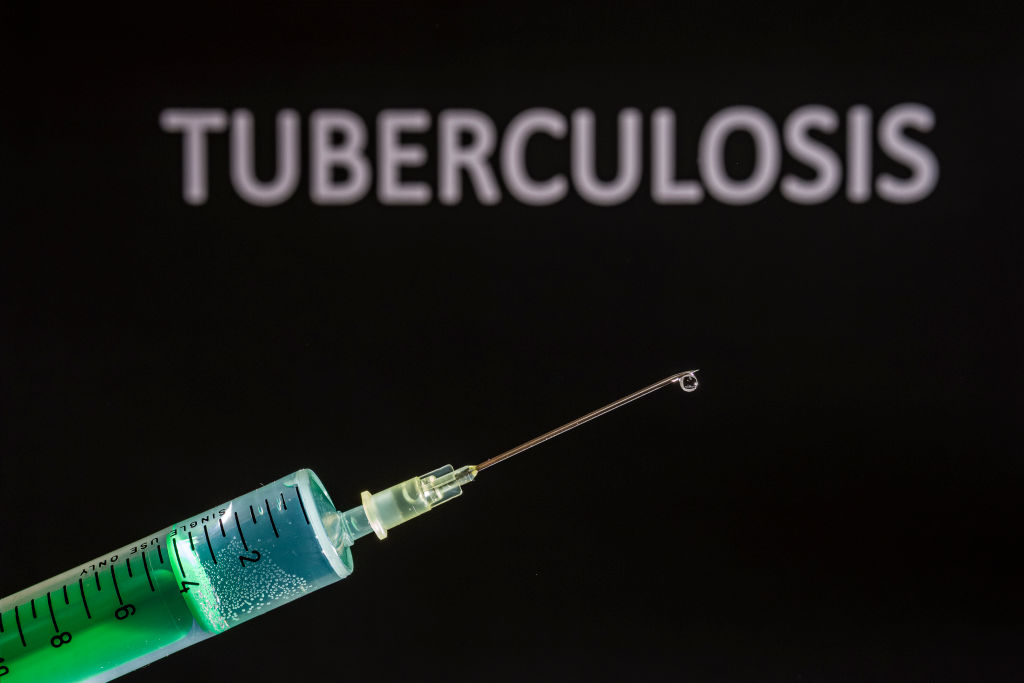 Nanded university gets Indian patent for nano drug delivery technology for tuberculosis