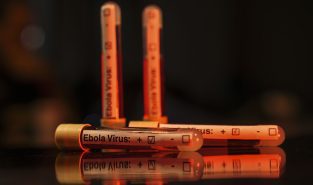 Treatment trials for Ebola strain behind Congo outbreak show promise, WHO says
