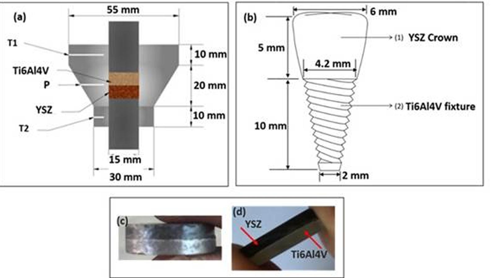 New bi-layered single-piece dental implant could reduce need for multiple surgeries