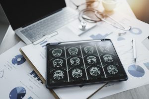 Scientists map gene activity in brain's prefrontal cortex