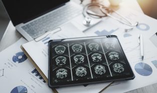 Scientists map gene activity in brain’s prefrontal cortex