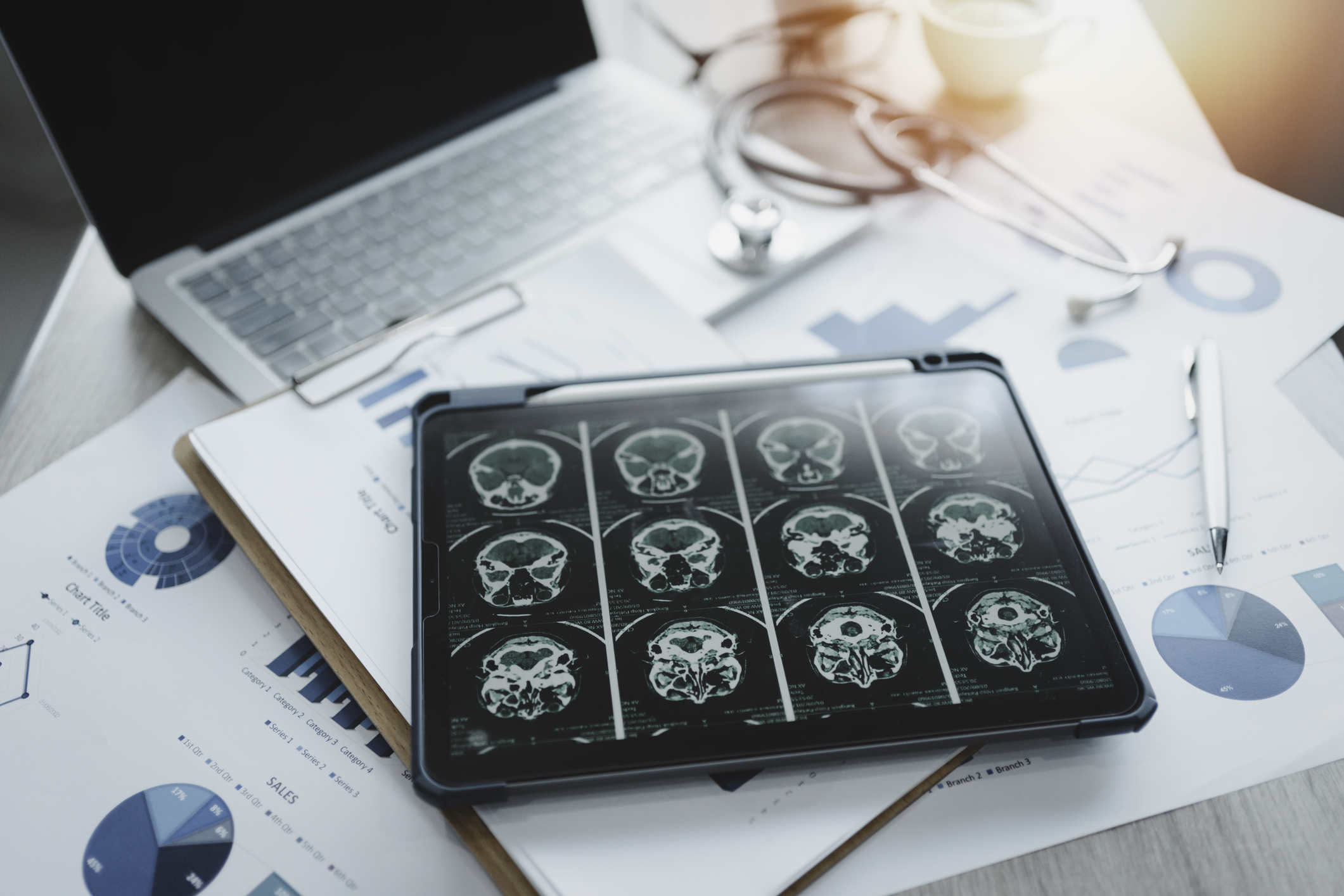 Scientists map gene activity in brain’s prefrontal cortex