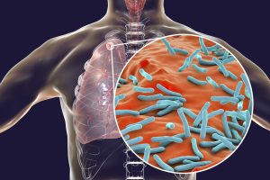 JOSH teams to be rolled out across 55 districts in 11 states to boost TB awareness